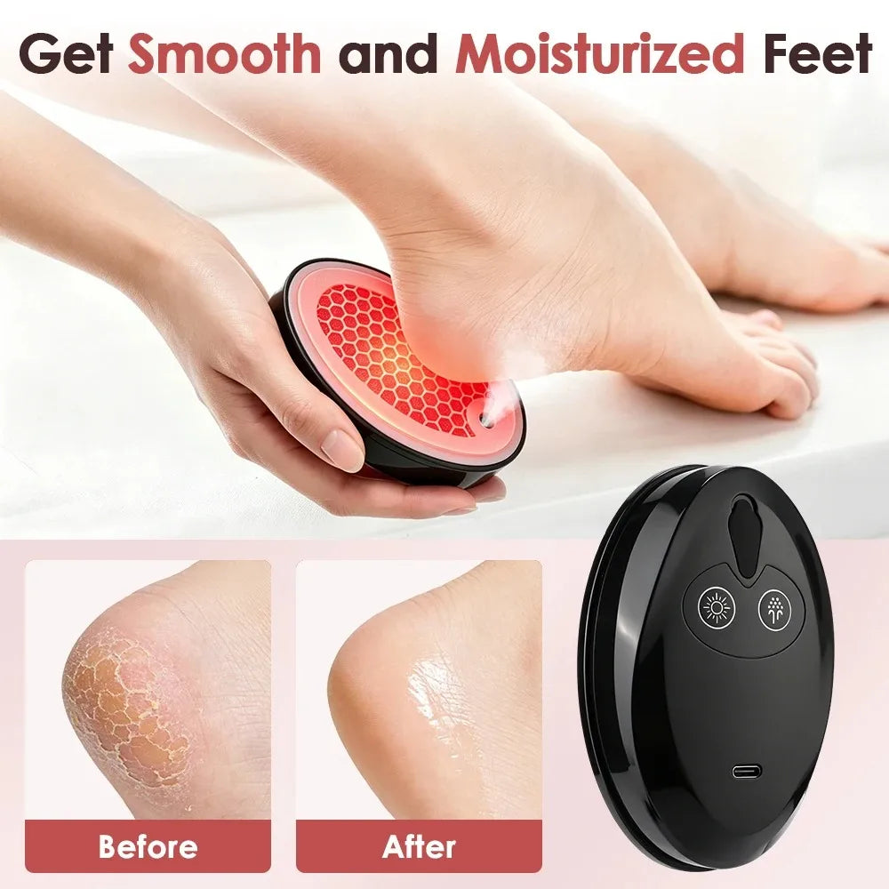 Waterproof Electric Foot Grinder Dead Skin Callus Remover Pedicure Tool Microcrystalline Foot Care Device Rechargeable 500mAh
